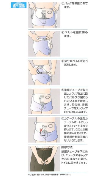 画像4: テレフレックス社　ベリーバッグ10枚入（腰部装着型集尿バッグ） (4)